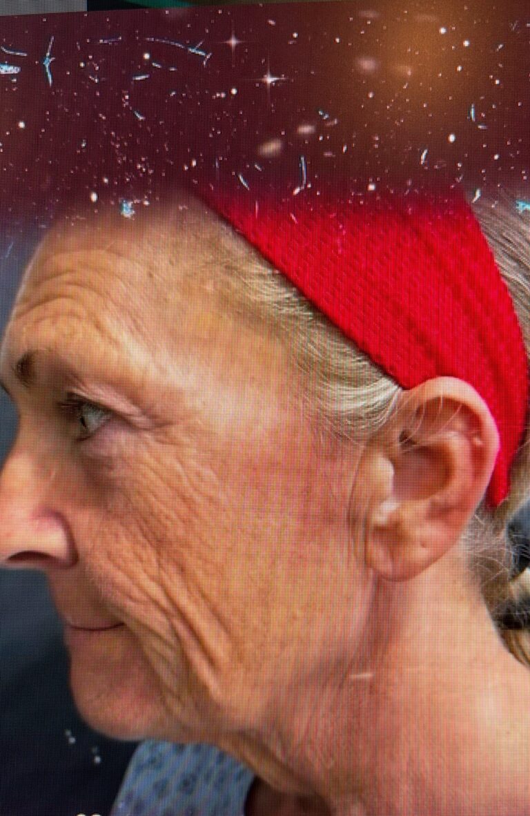 Before face/Neck lift